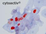 cytoactiv  -  Nachweis durch Färbemethode